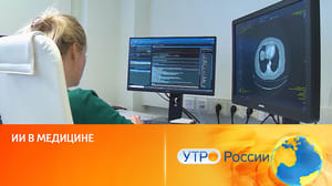Утро России Медицинские нейросети помогут поставить верный диагноз