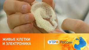 Утро России Биоимплант уха