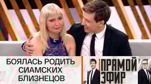 Прямой эфир Сиамская близняшка стала мамой