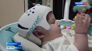 ВестиТамбов Пятимесячному малышу из Мичуринска нужна помощь после операции на черепе